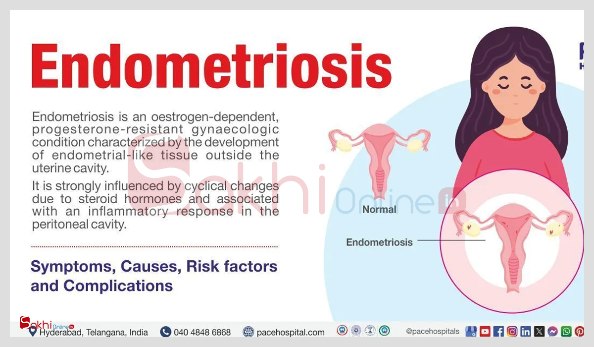 Health Tips: എൻഡോമെട്രിയോസിസിനെ എങ്ങനെ തിരിച്ചറിയാം? സ്ത്രീകള്‍ അവ​ഗണിക്കാന്‍ പാടില്ലാത്ത ലക്ഷണങ്ങള്‍