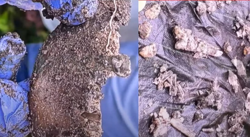 ജൈനമ്മ കൊലക്കേസ്: സെബാസ്റ്റ്യന്റെ വീട്ടില്‍ കണ്ടെത്തിയ മനുഷ്യ അസ്ഥി ഭാഗങ്ങളുടെ ദൃശ്യങ്ങള്‍ ട്വന്റിഫോറിന്