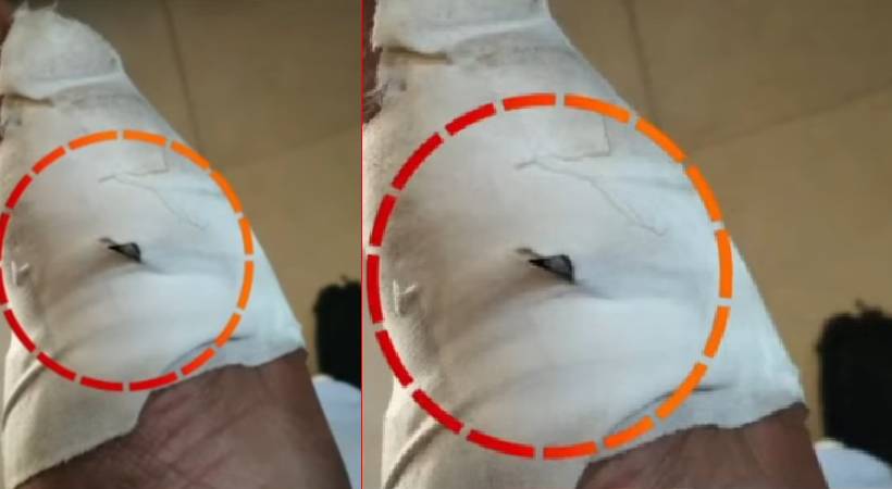 സര്‍ജിക്കല്‍ ബ്ലേഡ് ഉള്ളില്‍ വച്ച് തുന്നിക്കെട്ടി; പമ്പ ആശുപത്രിക്കെതിരെ ചികിത്സാപ്പിഴവ് ആരോപണം