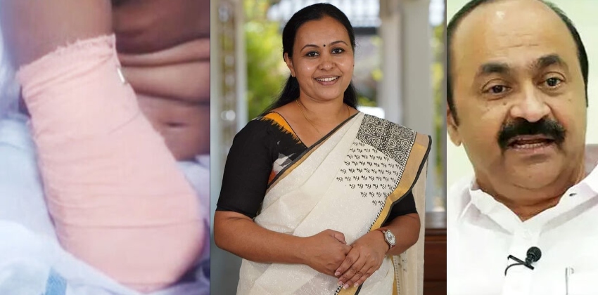 ‘ചികിത്സാപ്പിഴവിൽ കൈ നഷ്ടപ്പെട്ട ഒൻപതുവയസുകാരിക്ക് കൃത്രിമ കൈ നൽകും’; പ്രതിപക്ഷ നേതാവിന്റെ പ്രഖ്യാപനത്തിന് പിന്നാലെ സഹായവുമായി മന്ത്രി വീണാ ജോർജ്