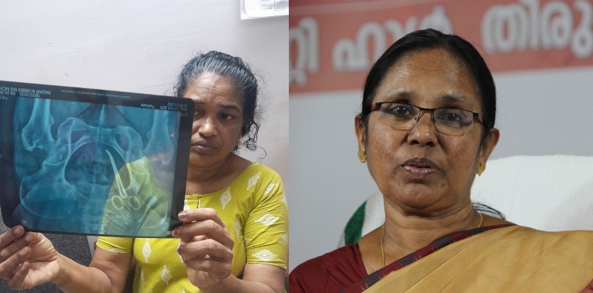 ‘അപൂർവമായി ഇത്തരം കാര്യങ്ങൾ വൈദ്യശാസ്ത്രത്തിൽ സംഭവിക്കാറുണ്ട്, സർക്കാർ ആശുപത്രിയിലെ സംവിധാനം ഒരുപാട് മെച്ചപ്പെട്ടു’; കെ കെ ശൈലജ