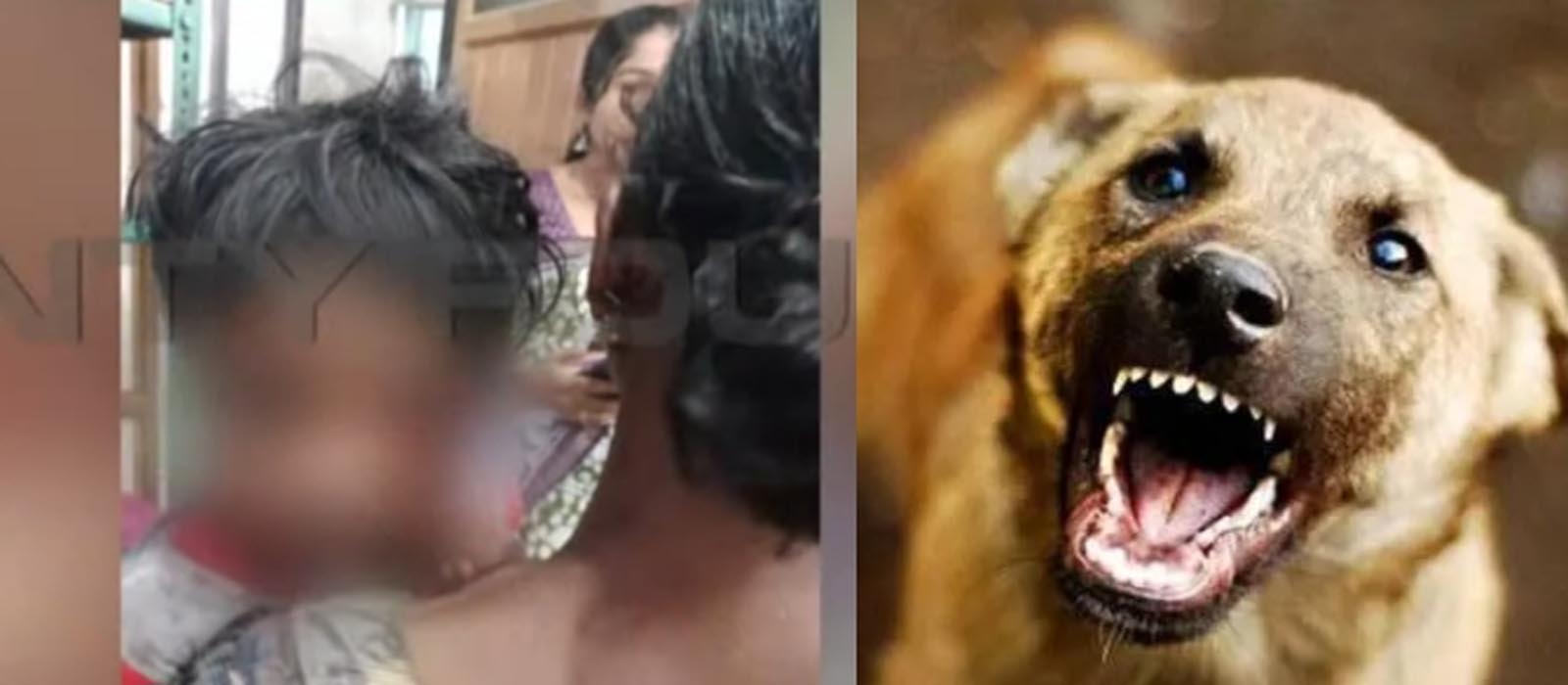 പത്തനംതിട്ടയിൽ മൂന്നു വയസ്സുകാരിയെ തെരുവുനായ കടിച്ചുകീറി; ഗുരുതര പരുക്ക്