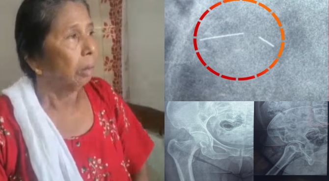 കുത്തിവെപ്പ് എടുത്തശേഷം ശരീരത്തിനുള്ളിൽ സൂചിയുടെ ഭാഗം കുടുങ്ങി; കോഴഞ്ചേരി ജില്ലാ ആശുപത്രിയിൽ ചികിത്സാ പിഴവ്