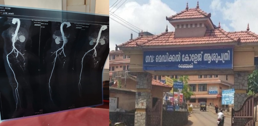 കാല് വേദനയുമായി എത്തി; ശസ്ത്രക്രിയയിൽ രോഗിയുടെ കാലിന്റെ ഞരമ്പുകൾ മുറിച്ചു മാറ്റി, മഞ്ചേരി മെഡിക്കൽ കോളജിൽ ഗുരുതര ചികിത്സാ പിഴവ്